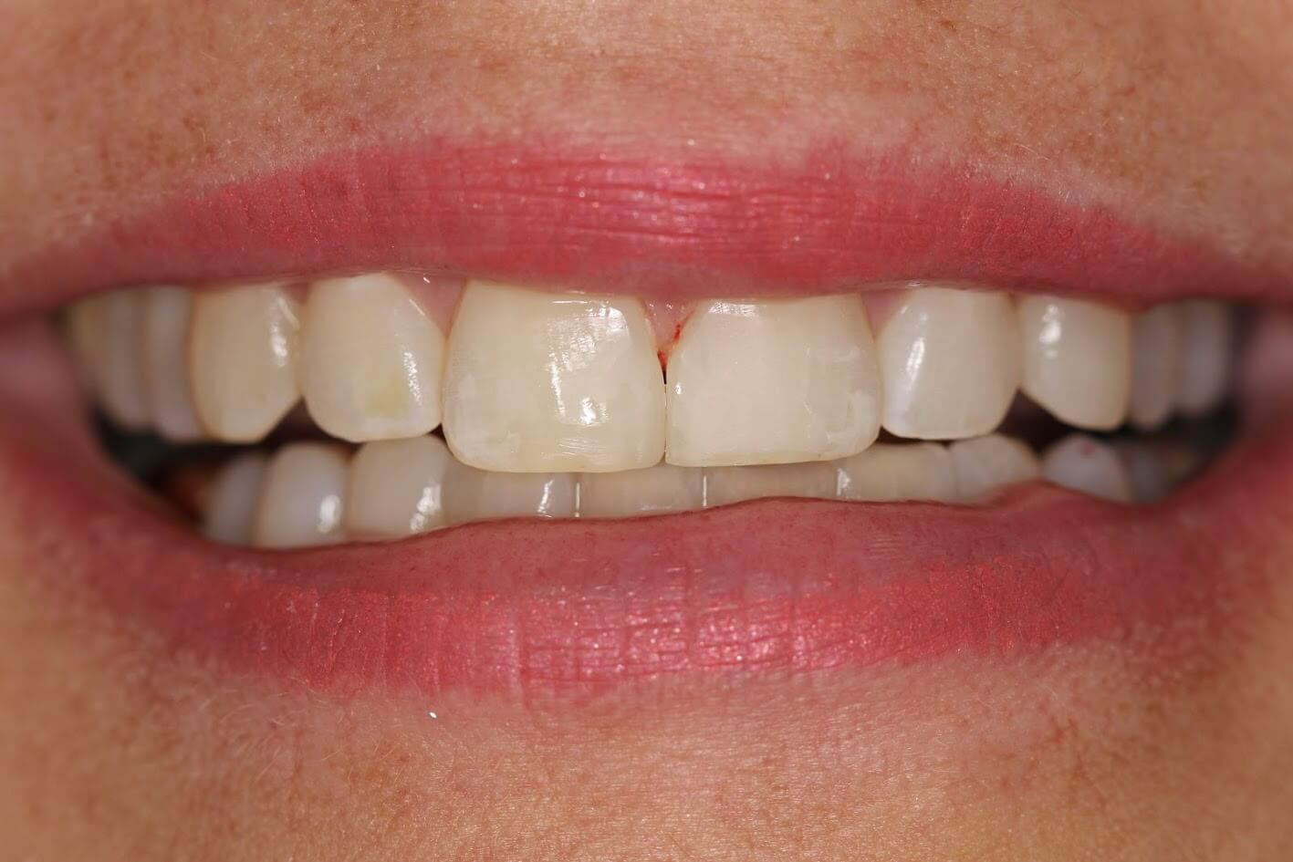 hammond dental after