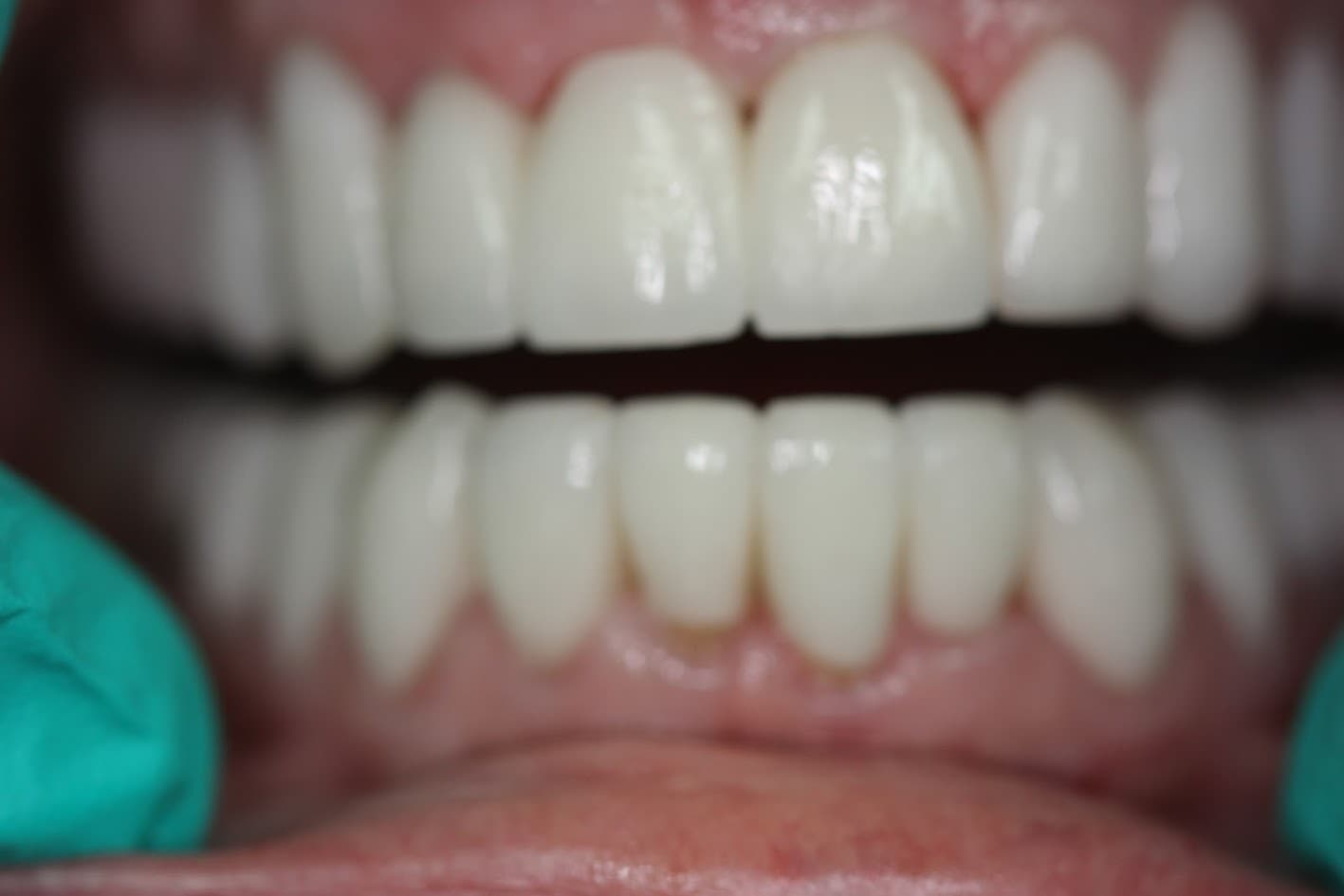 hammond dental after