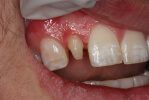 hammond dental before